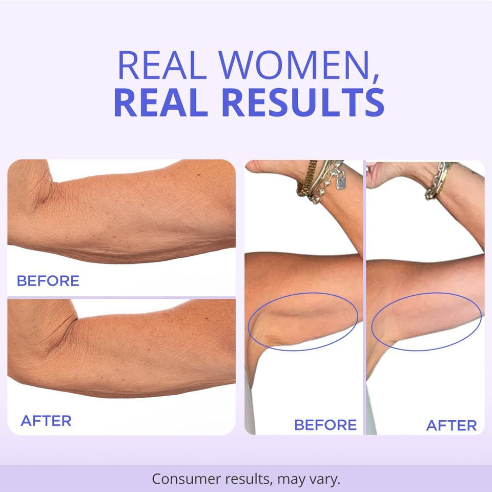 goPLre Sculpt & Tone Arm Cream - Firming & Tightening Cream - Visibly Smooths, Lifts, Sculpts Arms - ProTight Complex - Rice Protein, Shea Butter, Avocado - Clinically Tested - All Skin Types