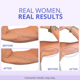 goPLre Sculpt & Tone Arm Cream - Firming & Tightening Cream - Visibly Smooths, Lifts, Sculpts Arms - ProTight Complex - Rice Protein, Shea Butter, Avocado - Clinically Tested - All Skin Types