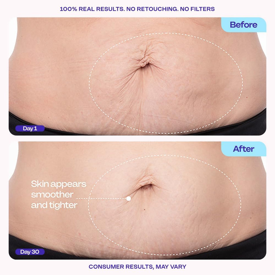 goPLre Firming Belly Cream - Dermatologist-Developed Moisturizer with MicroTight4 Complex - Green Microalgae, Longan Seed, Copper Tripeptide-1 - Quick Absorbing for Smooth, Firmer-Looking Skin