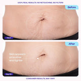 goPLre Firming Belly Cream - Dermatologist-Developed Moisturizer with MicroTight4 Complex - Green Microalgae, Longan Seed, Copper Tripeptide-1 - Quick Absorbing for Smooth, Firmer-Looking Skin