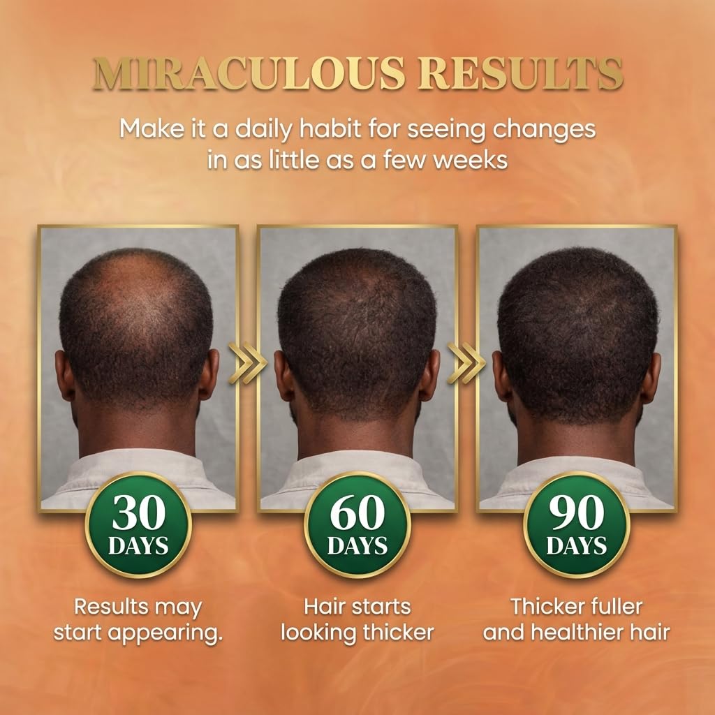 Batana Oil for Hair Growth Dr Sebi, 100% Raw Organic Batana Hair Mask from Honduras, Wild Growth Hair Oil, Scalp Oil Promotes Hair Thickness, Prevents Loss for Men & Women, 4.06 fl oz