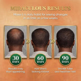 Batana Oil for Hair Growth Dr Sebi, 100% Raw Organic Batana Hair Mask from Honduras, Wild Growth Hair Oil, Scalp Oil Promotes Hair Thickness, Prevents Loss for Men & Women, 4.06 fl oz