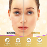 Under Eye Patches, 40 Pairs Eye Mask for Dark Circles, PLffy Eyes, Undereye Bags,Wrinkles,Eye Mask Patches with 24K Gold, Hyaluronic Acid,Rose & Aloe Vera, Eye Treatment Skin Care for Men & Women Gift