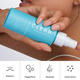 Paula's Choice CLEAR Exfoliating Back & Body Acne Spray, Bacne Spray with 2% BHA Salicylic Acid Back Acne Treatment for Clogged Pores, Blackheads & Breakouts, Alcohol-Free, Fragrance-Free, 4 Fl Oz
