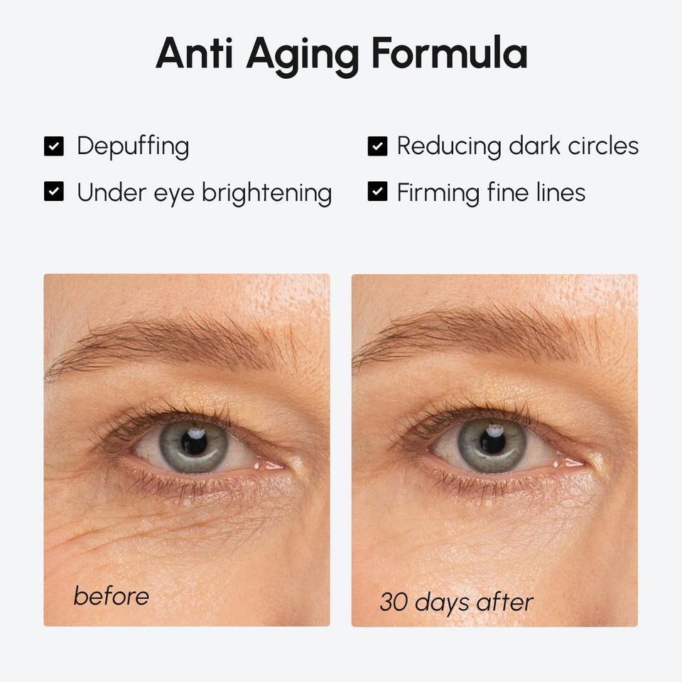 MAREE Under Eye Balm Stick Hydrating – Retinol Caffeine Under Eye Brightener Stick for Older Women – Collagen Undereye Cream for Dark Circles & Wrinkles – Skin Care Treatment Moisturizer