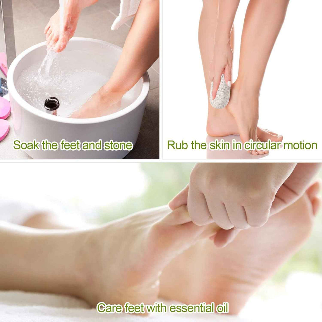 Asqraqo Natural Pumice Stone Pedicure Tools for Foot & Hand Callus Removal