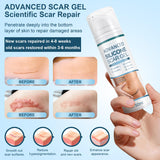Mitgary Advanced Scar Gel, Silicone Scar Gel, Treats Old and New Scars, Reduces the Appearance of Scars from, Body, Face, Stretch Marks, Surgical Scar, Keloids, Acne, Burns and More, 50g (1.7 Oz)