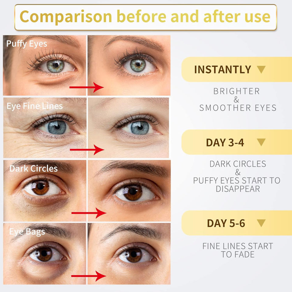 NAZANO 24K Gold Under Eye Patches - 60 Pack for PLffy Eyes, Dark Circles, Bags & Wrinkles with Collagen & Hyaluronic Acid - Eye Care Pads for Daily Skincare (Gold)