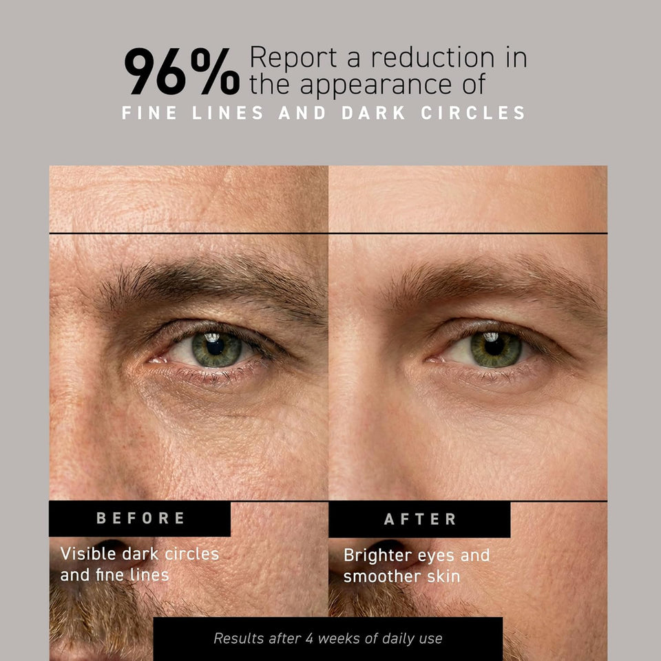 Brickell Men's Restoring Under Eye Cream for Men, Natural and Organic Anti Aging Eye Balm To Reduce PLffiness, Wrinkles, Dark Circles, Crows Feet and Under Eye Bags, 0.5 Ounce, Unscented