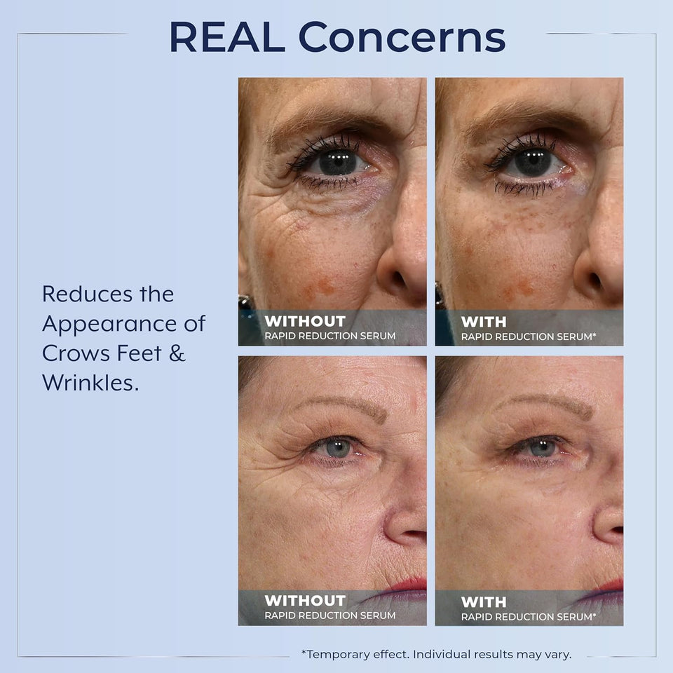 Plexaderm Rapid Reduction Eye Serum - Visibly Reduces Under-Eye Bags, Wrinkles, Dark Circles, Fine Lines & Crow's Feet Instantly, Anti Aging Wrinkle Remover for Face, Full Size Tube