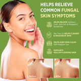 Roycederm Antifungal Bar Soap - Tea tree Oil Soap - Athlete’s Foot Treatment for Jock Itch & Ringworm - Medicated Antifungal Soap with Clotrimazole 1% - Tea Tree Oil Scent, 1 Pack