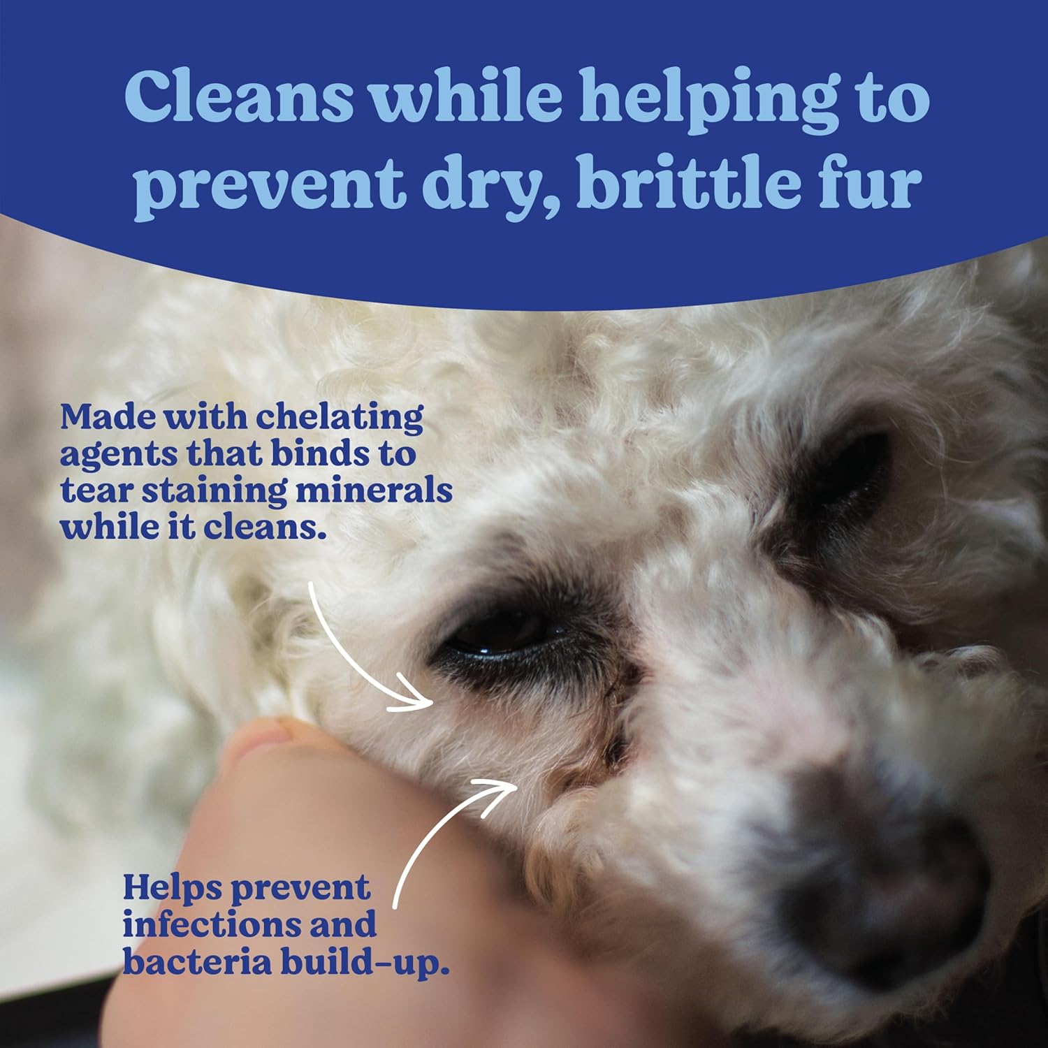 Angel's Eyes Gentle Tear Stain Wipes for Dogs and Cats, Presoaked, 100 Count, Textured