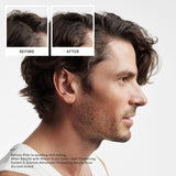 Nioxin System 2 Scalp + Hair Thickening Shampoo for Natural Hair with Progressed Thinning | Cleanse & Boost Hair Density with Niacinamide & Biotin