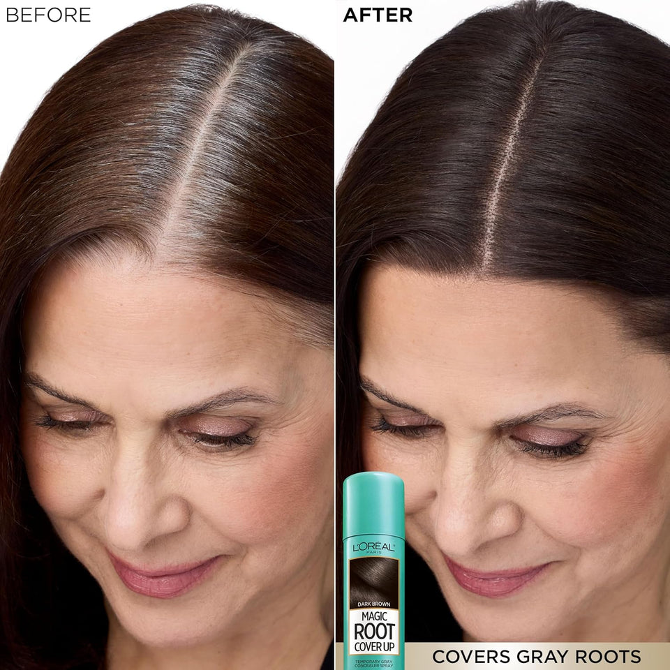 L'Oreal Paris Root Cover Up Temporary Gray Concealer Spray, Hair Color Spray with Filling & Thickening Coverage, Dark Brown, Packaging May Vary